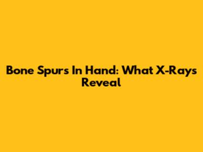 Bone Spurs In Hand: What X-Rays Reveal