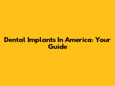 Dental Implants In America: Your Guide