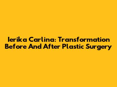 Ierika Carlina: Transformation Before And After Plastic Surgery