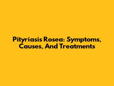 Pityriasis Rosea: Symptoms, Causes, And Treatments