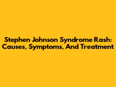 Stephen Johnson Syndrome Rash: Causes, Symptoms, And Treatment